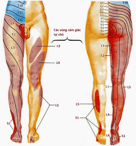 Triệu chứng thoát vị đĩa đệm lưng