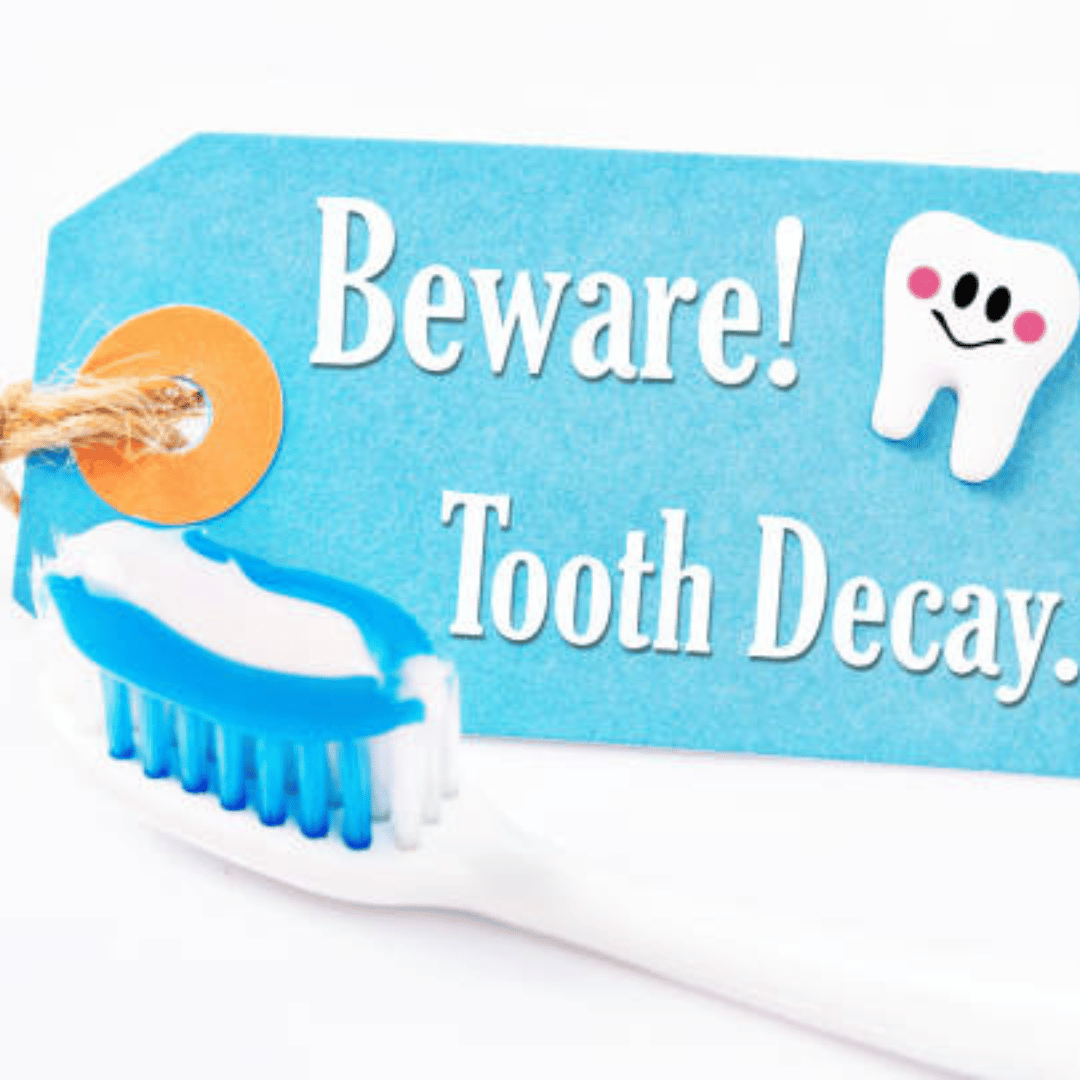 Dental Sealants