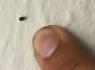 A close up of a fingernail and a bug

Description automatically generated