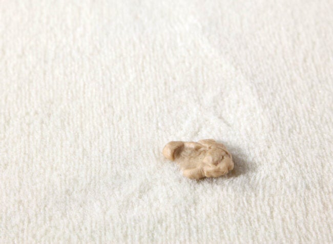 How to Remove Gum From Carpet