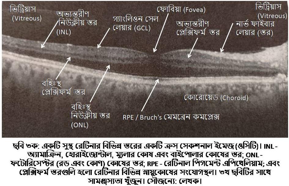 D:\Rashid\OCT-Optical coherence tomography\ছবি ৩ক OCT-Right eye retina (myself)- April 12 2024.jpg