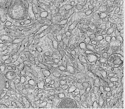 Smooth Endoplasmic Reticulum - Definition, Structure & Functions