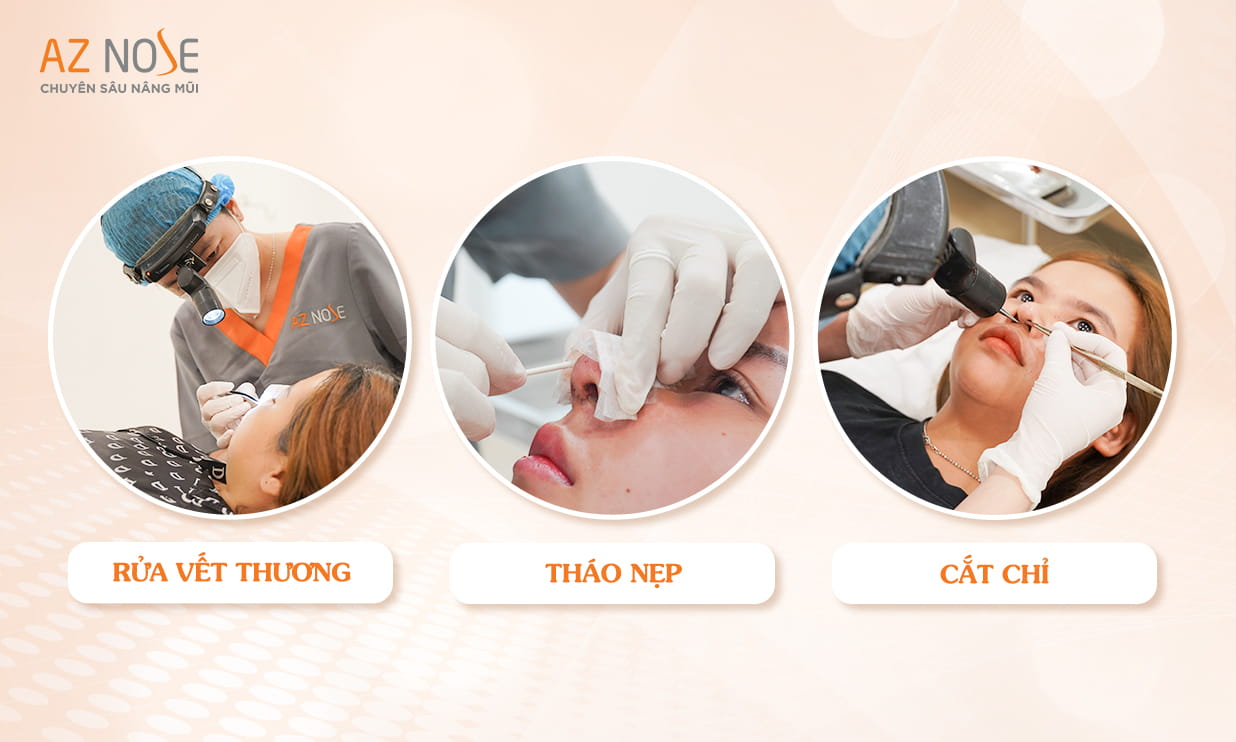 Quy Trình Nâng Mũi tại Phòng Khám AZ NOSE: Tự Tin Với Dáng Mũi Hoàn Hảo 0aIL6EHO1Etc0NIp8DjHM6CLckY-b9QBmM9n3agfR7UDfyvVEXnTL-QG_zKGap1OV0NSWi9vCc3qXLU56ZANnSf7J0wExq7ruzDBMmKruzK-VP7U5VU90btURQFZGPLy_loXhcXf16fhXEHGbu-GjYg