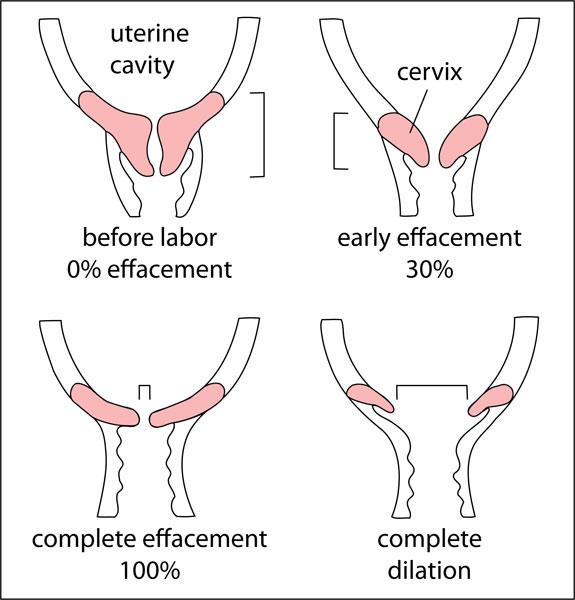 Dinoprostone - Reproductive - Medbullets Step 1