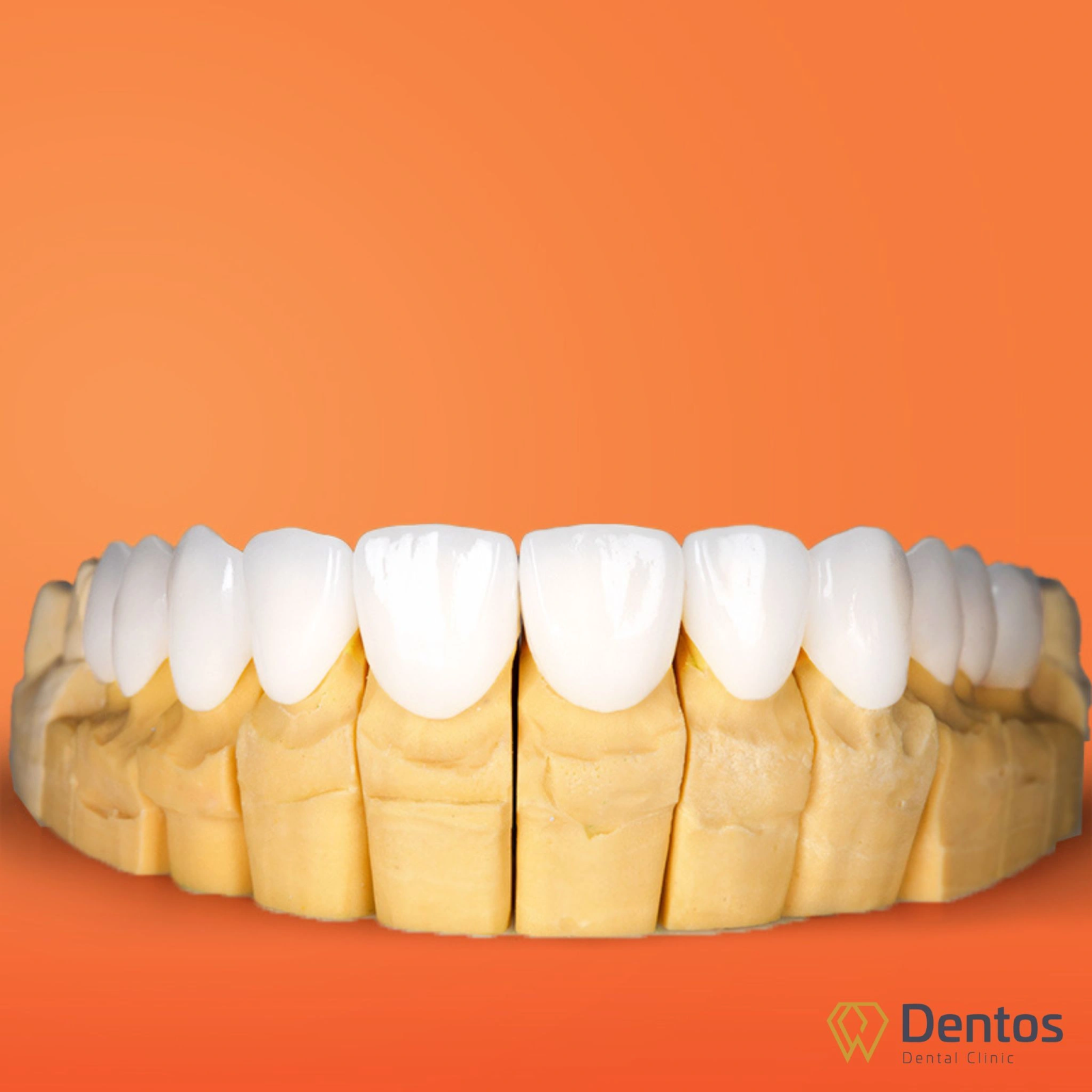 Tìm hiểu bảng giá răng sứ thẩm mỹ mới & chi tiết nhất tại nha khoa Dentos
