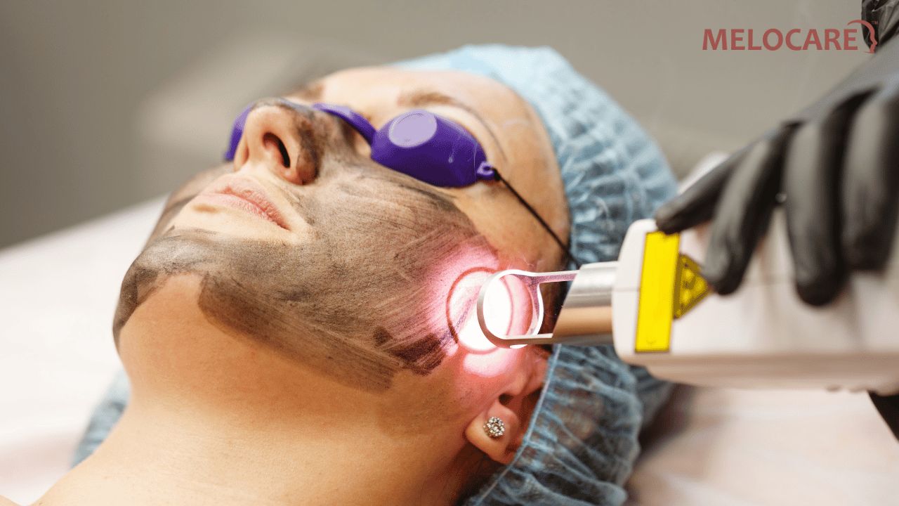 laser skin clinic in Delhi