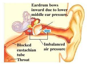 Blocked Ear and Blocked Nose | ENT Specialist Singapore