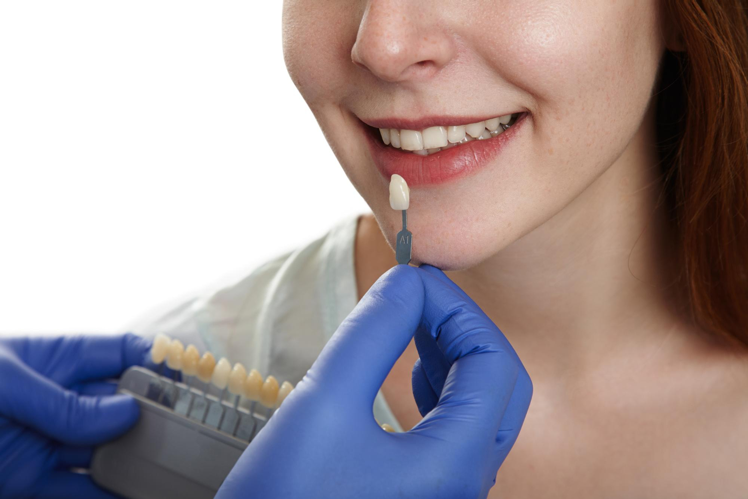 Bọc răng sứ không mài có nhiều ưu điểm so với phương pháp bọc răng sứ truyền thống