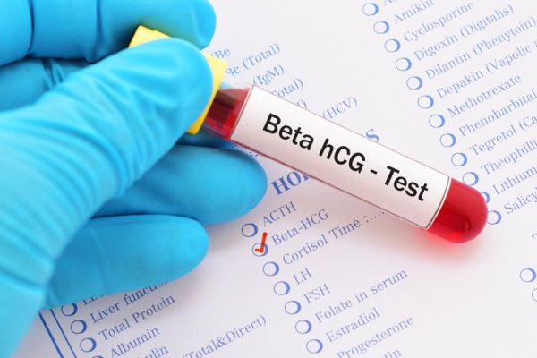 Xét nghiệm beta HCG giúp phát hiện xem người phụ nữ có thai hay không 