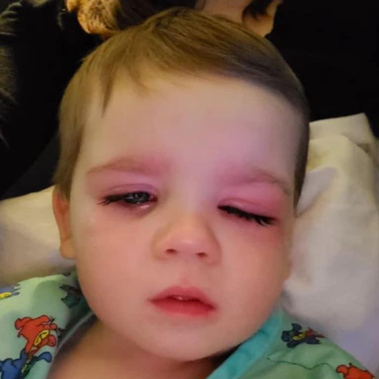 Mum's warning as baby nearly loses eye from 'dirty' bath toy | Adelaide Now