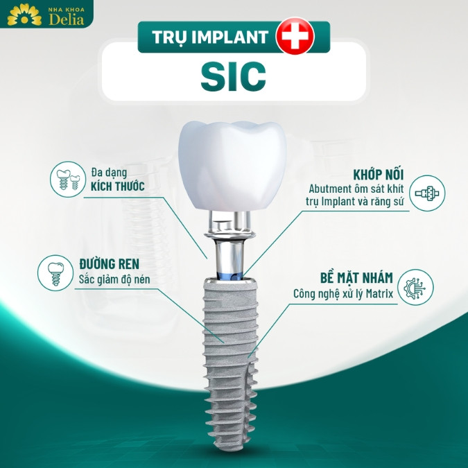Tìm hiểu cấu tạo của trụ Implant SIC 