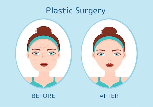 Plastic Surgery 