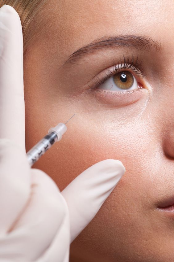 Picture of a lady using botox under eyes treament