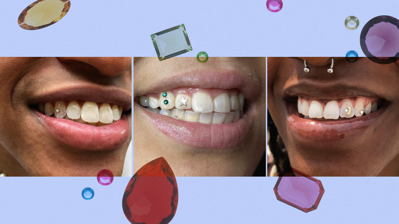 Removable Grillz for Teeth: Flash Your Smile!