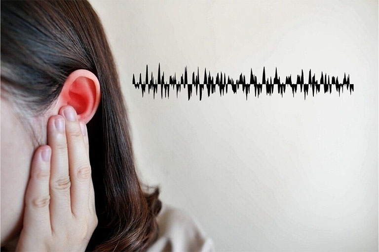 Nguyên nhân ù tai 