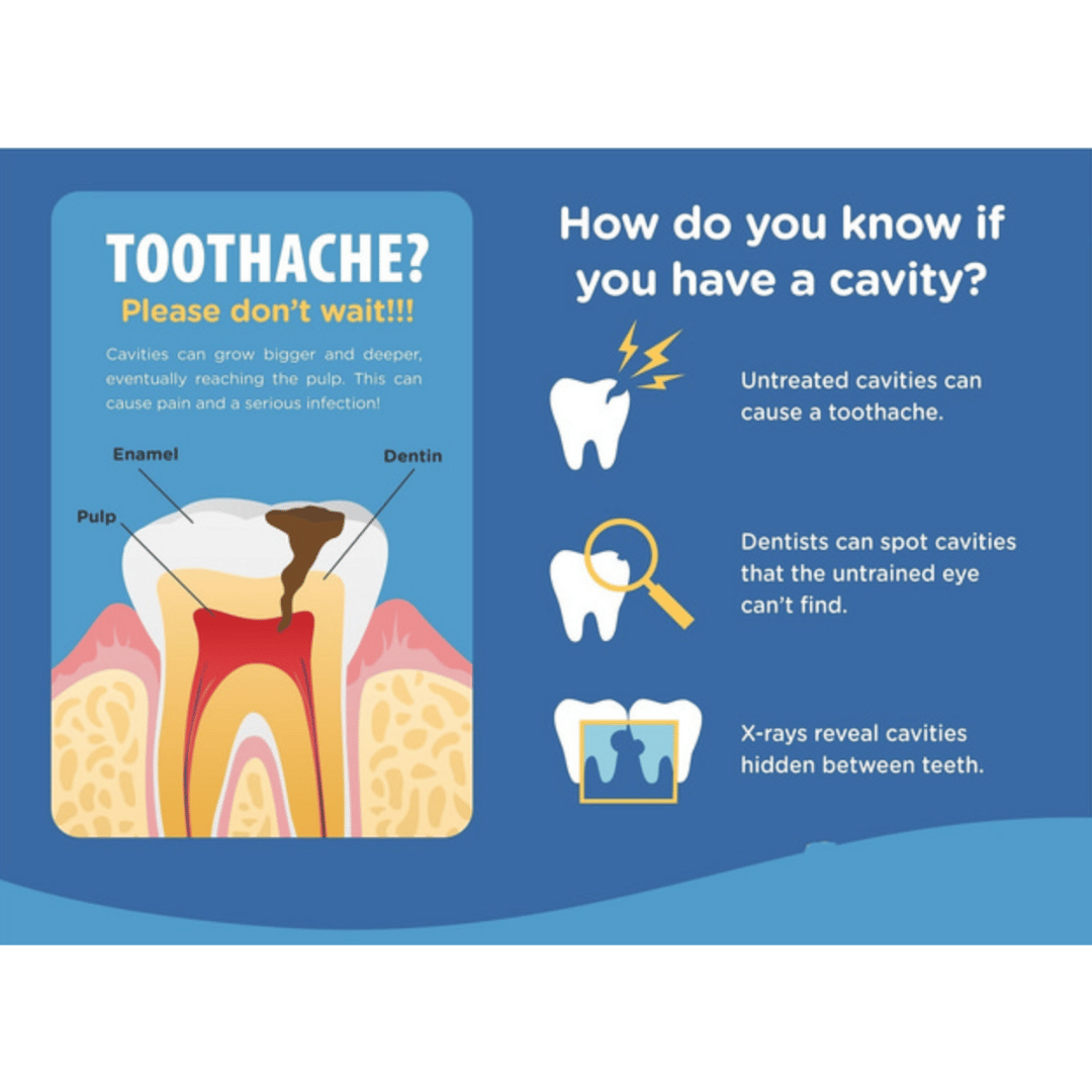 Cavity Filling