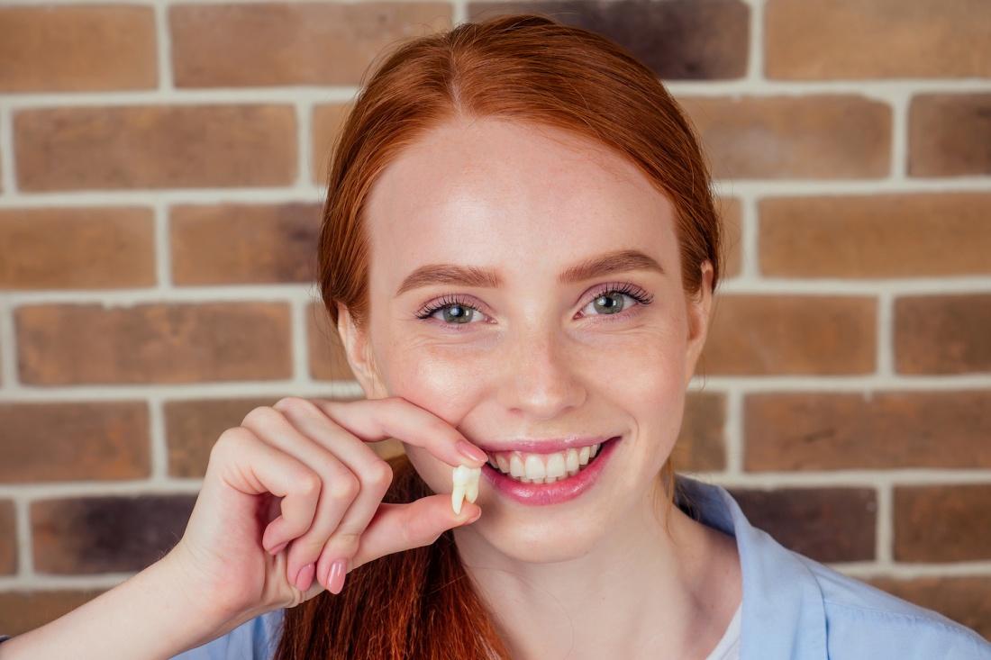 wisdom teeth extraction in Woodbridge