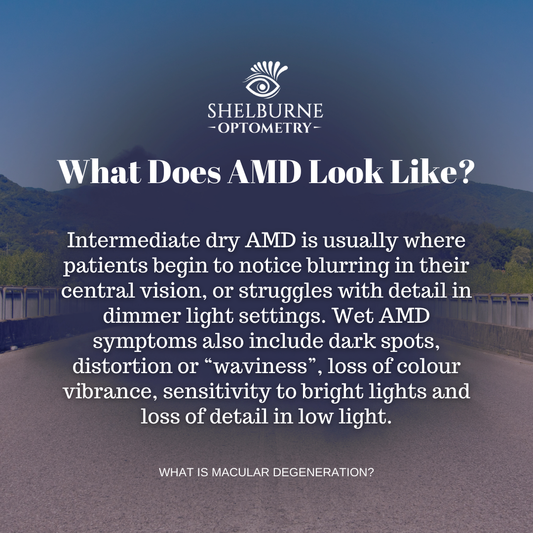 What Does AMD Look Like? Intermediate dry AMD is usually where patients begin to notice blurring in their central vision, or struggles with detail in dimmer light settings. Wet AMD symptoms also include dark spots, distortion or "waviness", loss of colour vibrance, sensitivity to bright lights and loss of detail in low light.
