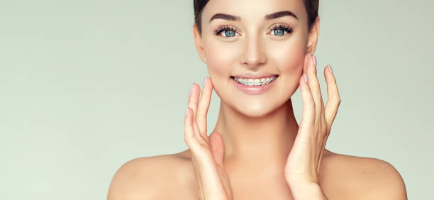 The Rising Popularity of Braces in Singapore