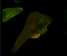 Live-cell imaging of an NK cell stained with Invitrogen CellLight Actin-RFP and GFP-centrin interacting with a target K562 cell stained with Invitrogen CellLight Actin-GFP.