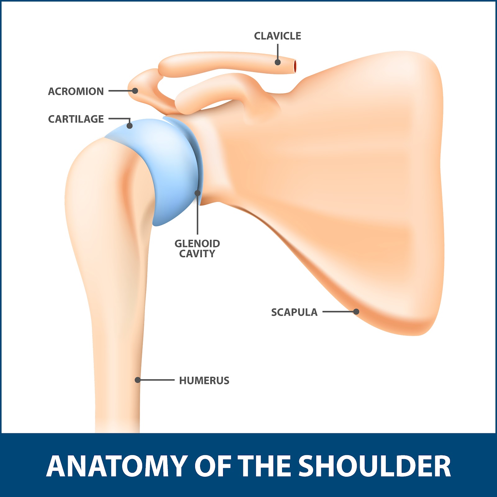 Shoulder Glenoid Fracture | Florida Orthopaedic Institute