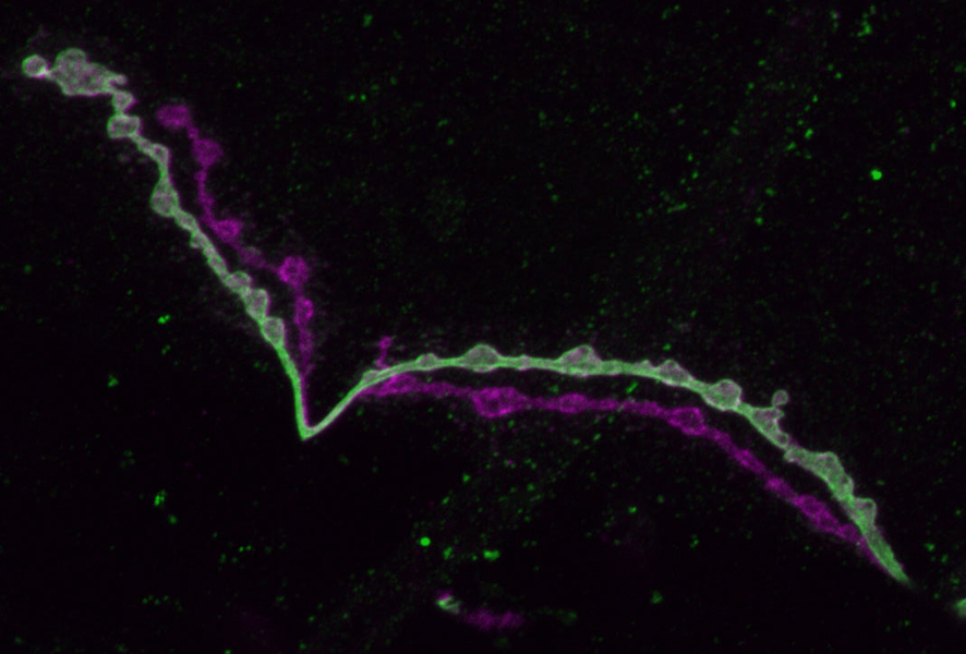 Long, thin, bumpy extensions of two neurons extend from upper left to bottom right across a black background. One is light green, the other is magenta. The light green one features patches of darker green amid little bumps along its length.