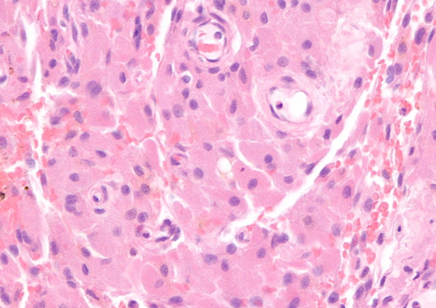 A microscope view of a human tissue

Description automatically generated