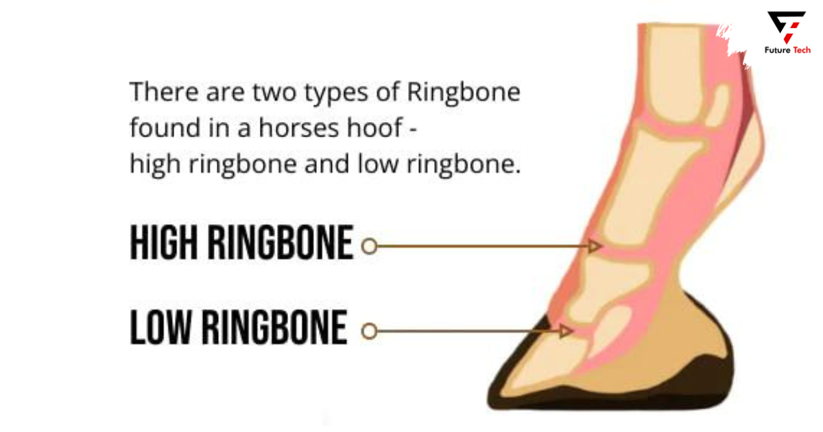 Categories of ringBone