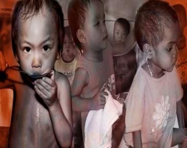 Pandemic causes an increase in the number of malnourished children – City  Government of Koronadal