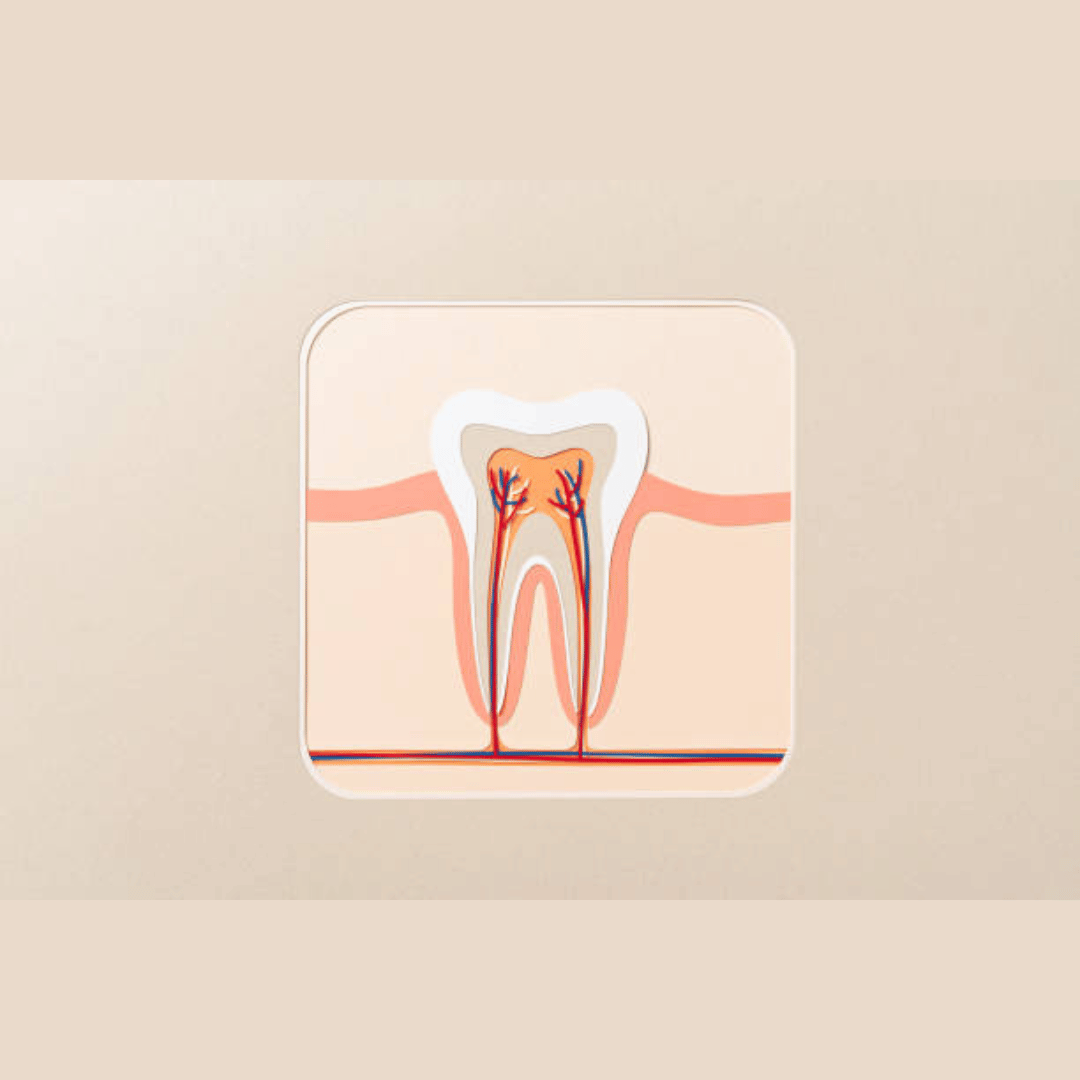 Are Root Canals Painful