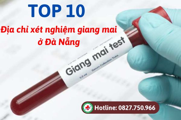 TOP 10 địa chỉ xét nghiệm giang mai