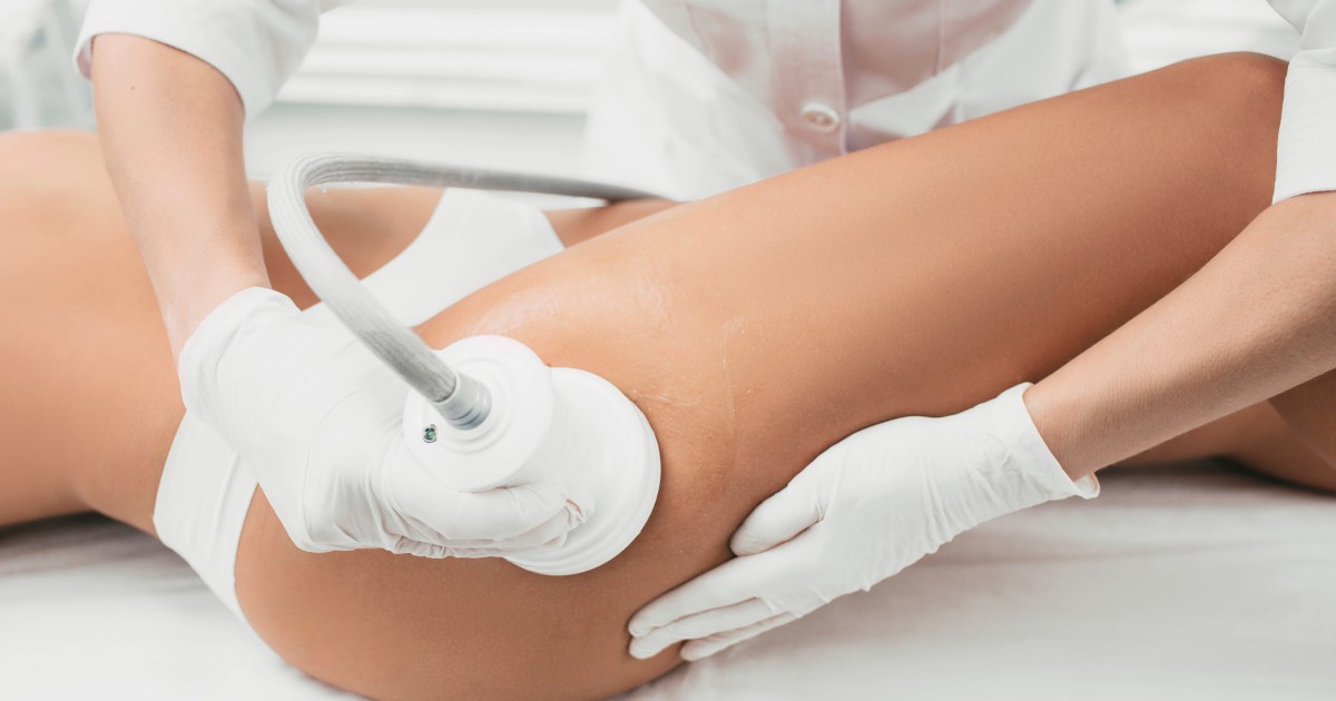 Does Liposuction Help With Cellulite Liposuction
