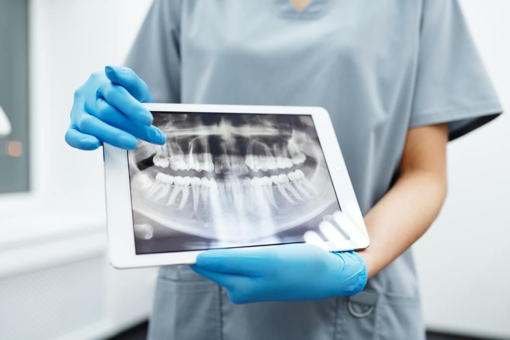 Image d'une personne utilisant une radiographie dentaire sur un iPad pour expliquer le traitement de l'extraction des dents de sagesse.