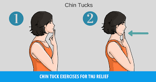 Chin Tuck Exercise for TMJ Relief – JawFlex®