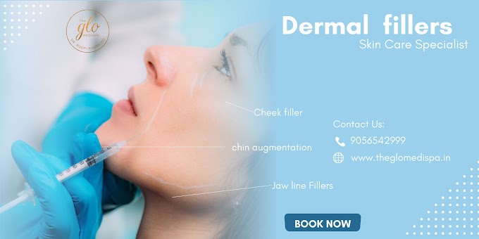 Top Benefits of Dermal Fillers