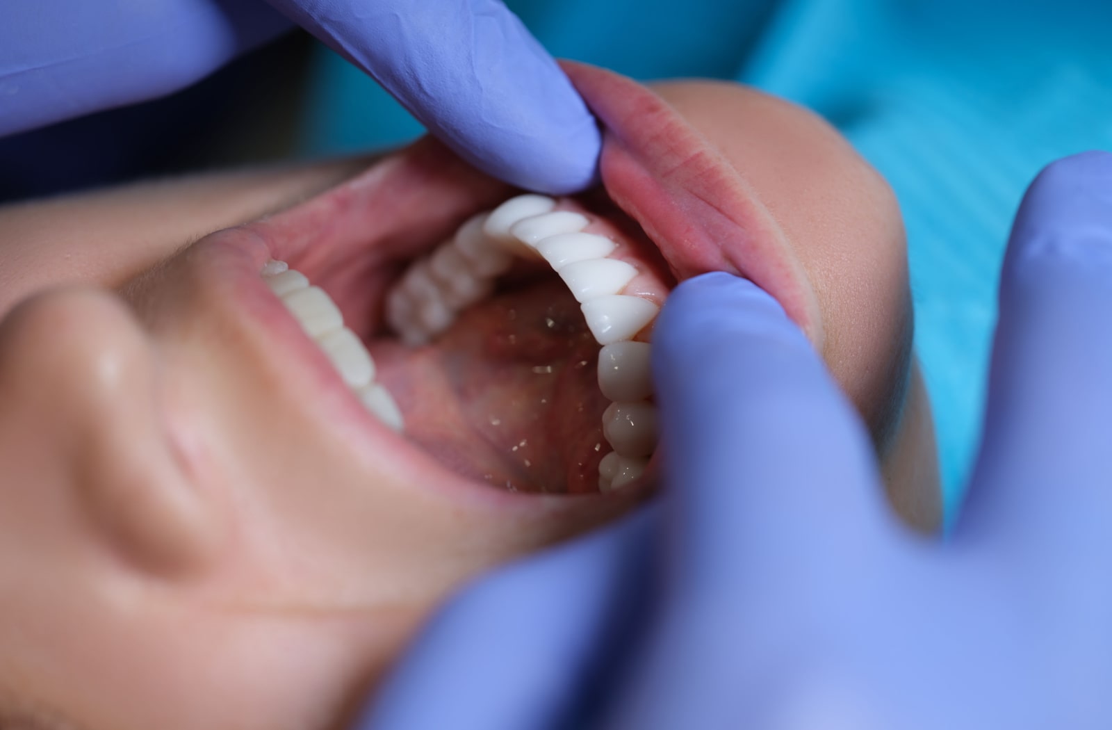 A dentist looks inside a patient's mouth to check for any cavities