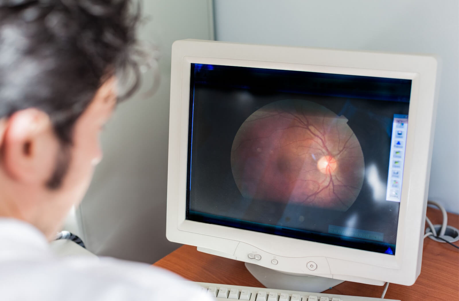 An image of a retina on a computer screen. A male eye doctor is out of focus in the foreground, looking at the image.