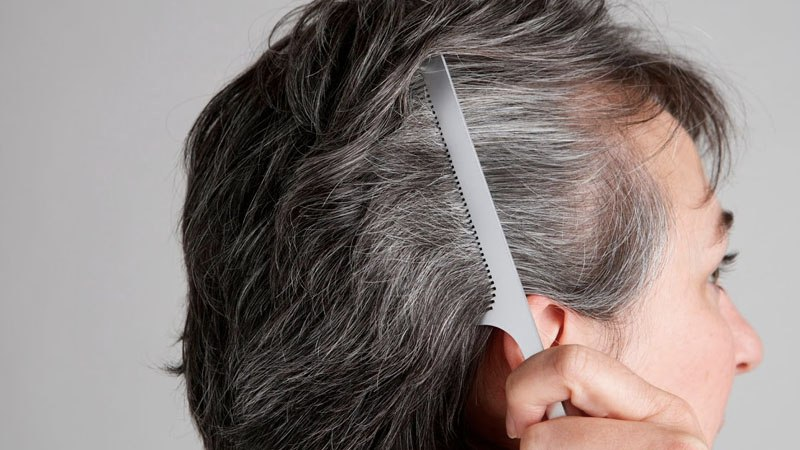 Nguyên nhân tóc bạc sớm ở nam giới