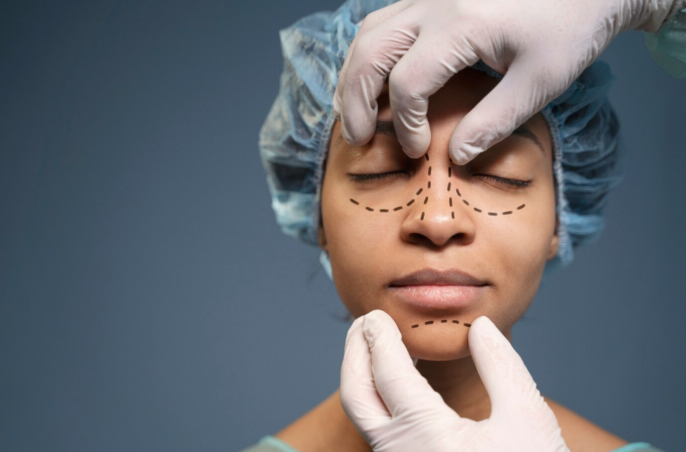 Phẫu thuật được cho là phương pháp tạo hình mũi nhanh chóng và hiệu quả nhất 