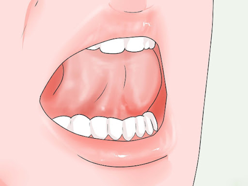 A close up of a mouth

Description automatically generated