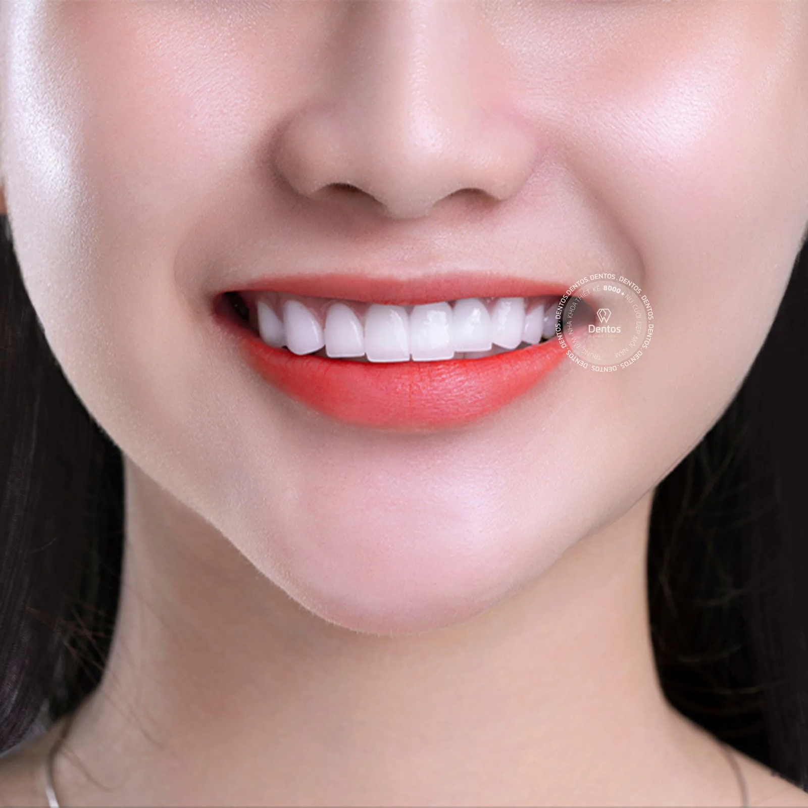 Chi tiết bảng giá răng sứ Zirconia 2024 - Nha khoa Dentos