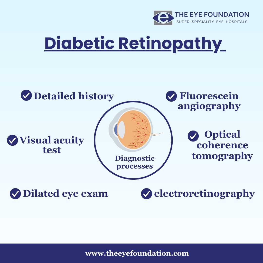 diagnostic-process-of-diabetic-retinopathy