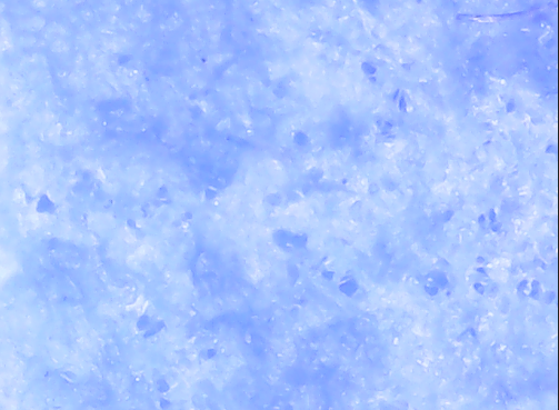 A close up of a blue surface
Description automatically generated