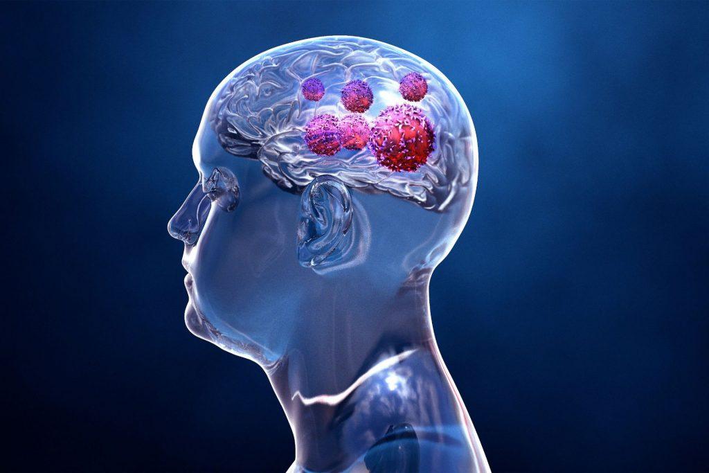 Symptoms of Traumatic Brain Injury