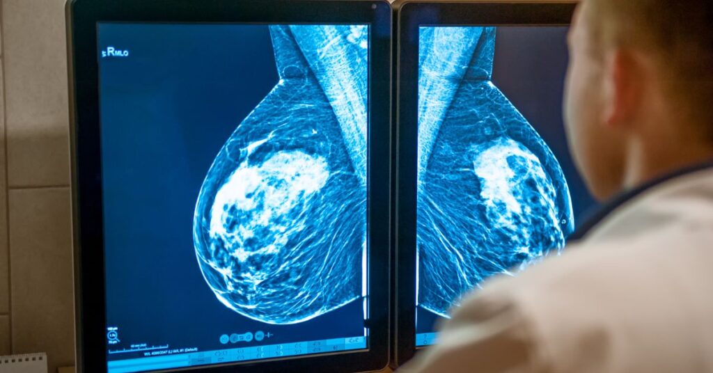 Breast Health Mammograms