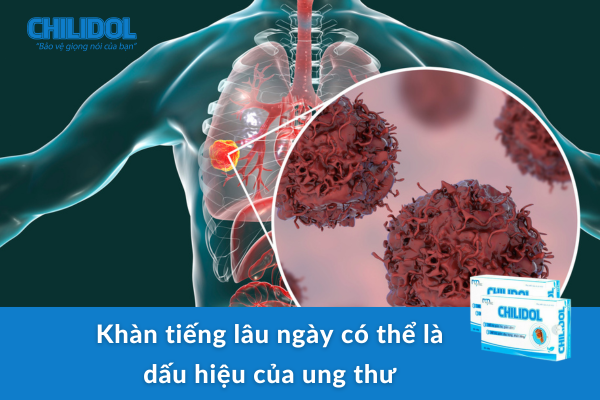 Khàn tiếng lâu ngày có thể là dấu hiệu của ung thư