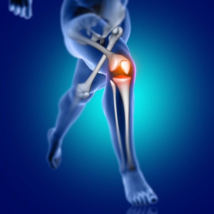Risks of Delaying Knee Replacement Surgery
