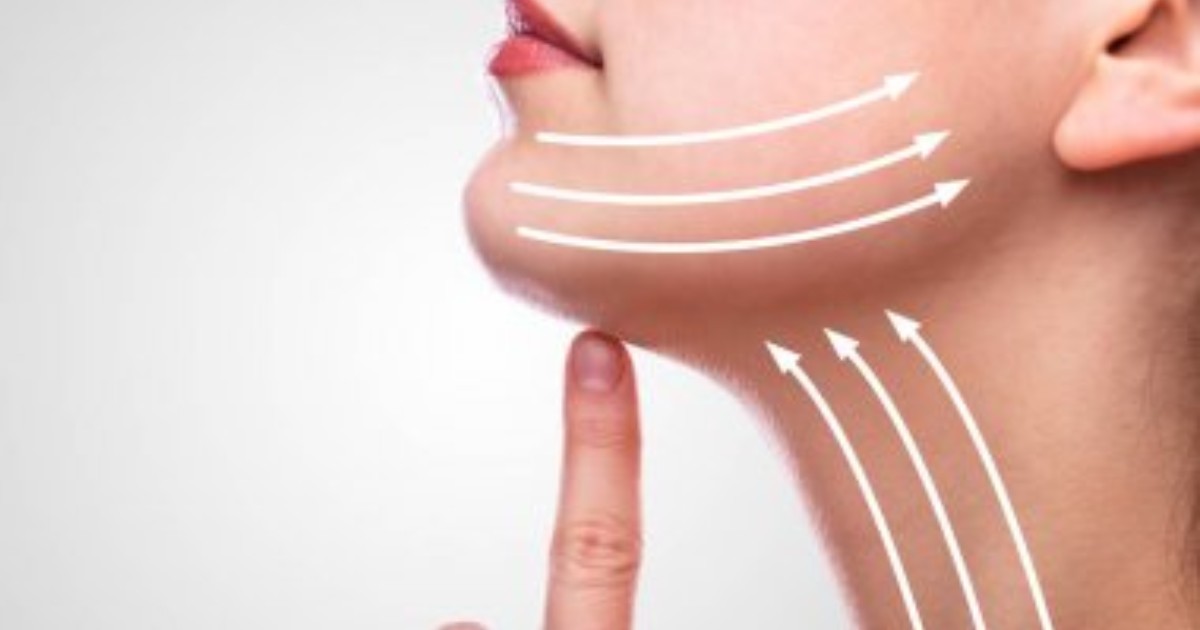 Cost Of Neck Liposuction