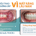 [HỎI ĐÁP BÁC SĨ] - KHẢ NĂNG TRỒNG TRỤ IMPLANT MỸ SAU KHI MẤT RĂNG L U NĂM VÀ SỬ DỤNG HÀM THÁO LẮP