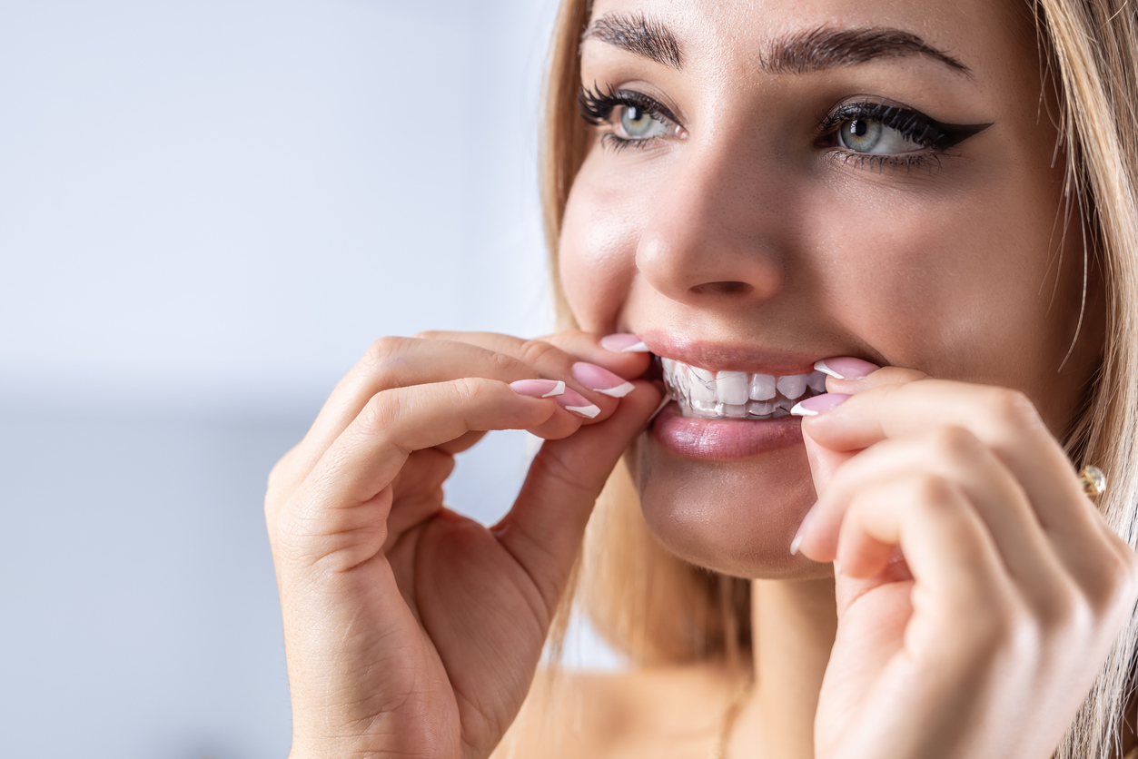 woman putting on clear aligners